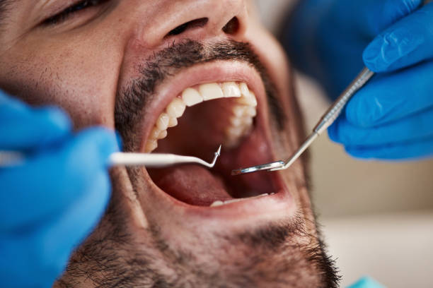 Best Walk-In Emergency Dentist in Holcom, KS