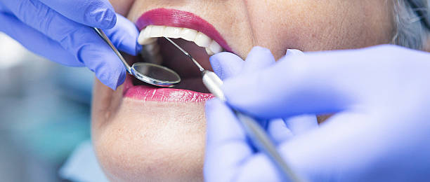 Best Emergency Tooth Extraction in Holcom, KS